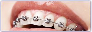 Tratamientos de Odontología