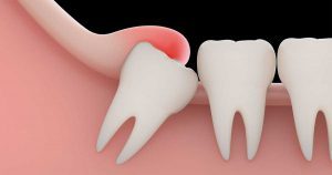 Tratamientos de Odontología