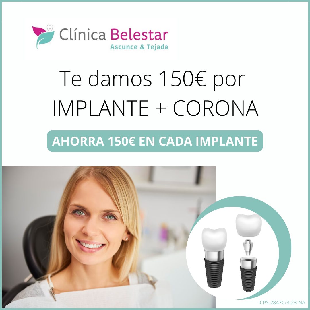Implantes dentales Pamplona ※ Los mejores precios ※ Clínica Belestar